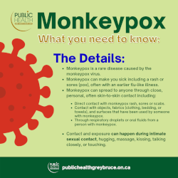 Monkeypox symptoms infographic